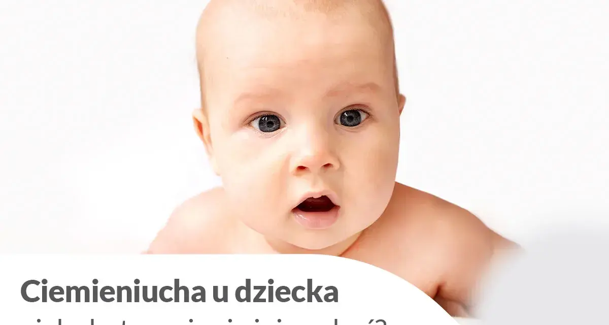 Urocze niemowlę z zaciekawioną miną. Tekst informuje o ciemieniuchy u dziecka i sposobach jej usuwania.