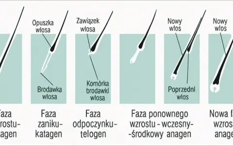 Cykl życia włosa: anagen, katagen, telogen. Widać mieszek włosowy, brodawkę i komórki tworzące nowy włos.
