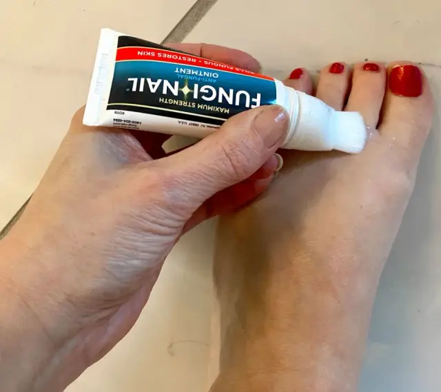 Dłoń aplikuje maść Fungi Nail na paznokcie u stóp. Preparat, podobny do żelu, zawiera metronidazol, pomagając w walce z grzybicą.