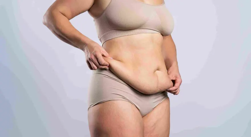 Kobieta w bieliźnie pokazuje fałdy brzuszne, rozważając abdominoplastykę.