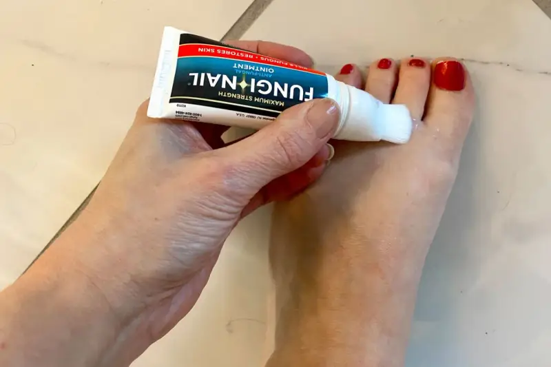 Dłoń aplikuje maść Fungi Nail na paznokcie u stóp. Preparat, podobny do żelu, zawiera metronidazol, pomagając w walce z grzybicą.